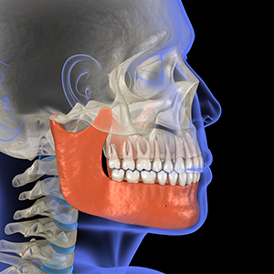 TMJ Disorder