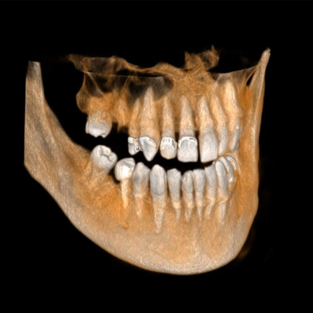 Hpw can CBCT help you?